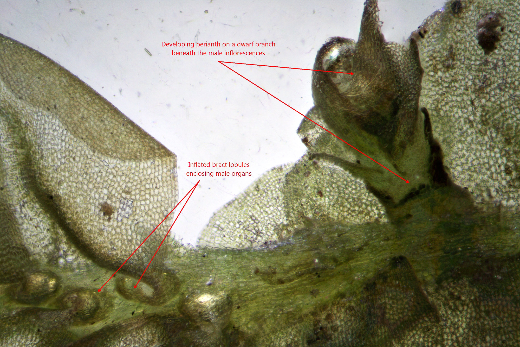 Anteridyum